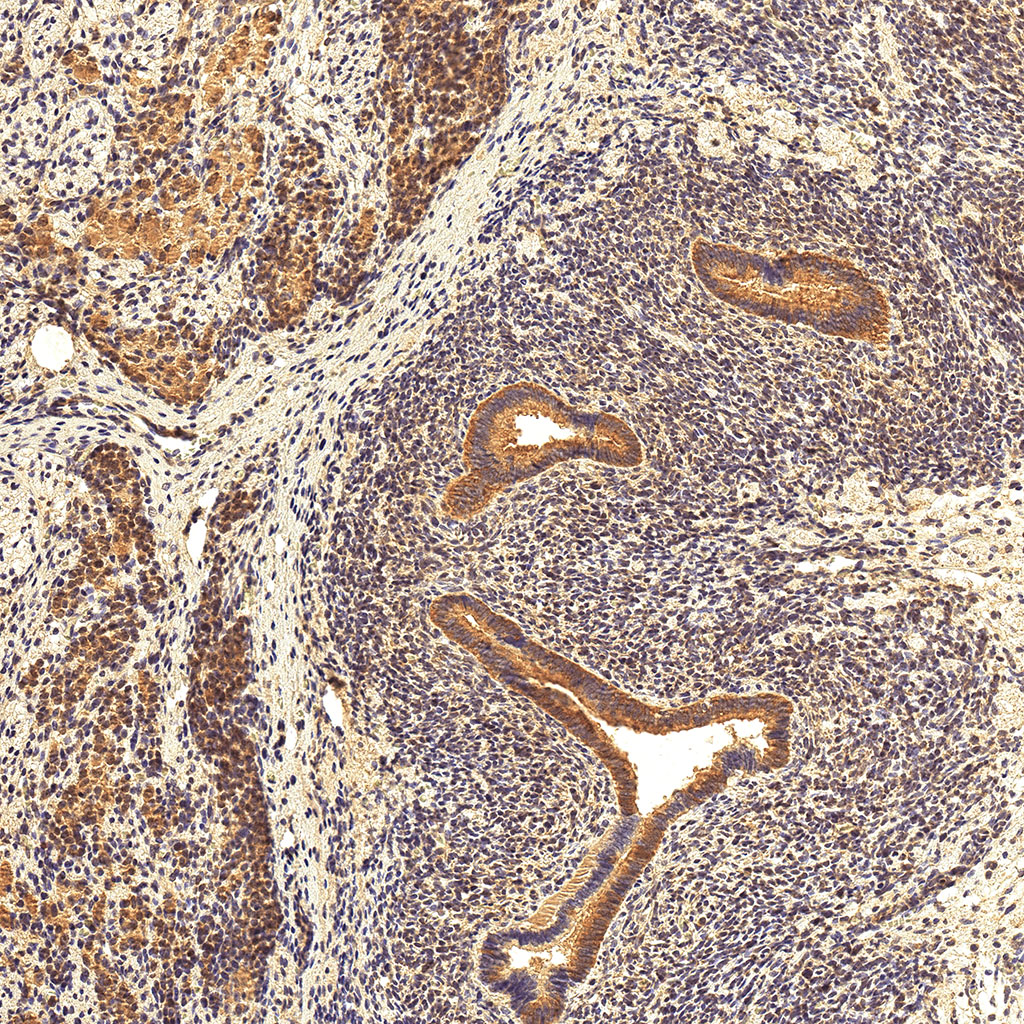 sars-cov-2 gene expression in a human fetus